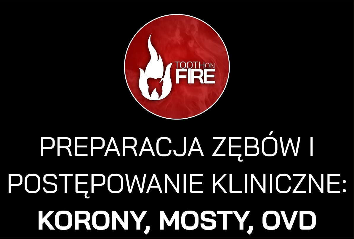 PREPARACJA ZĘBÓW I POSTĘPOWANIE KLINICZNE: KORONY, MOSTY, OVD