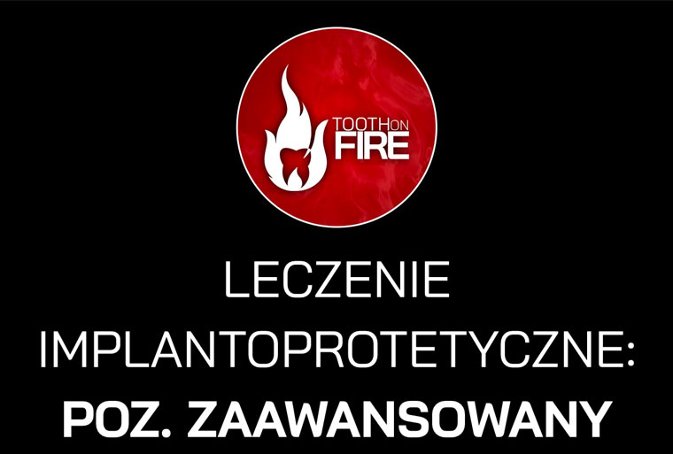 LECZENIE IMPLANTOPROTETYCZNE: POZ. ZAAWANSOWANY