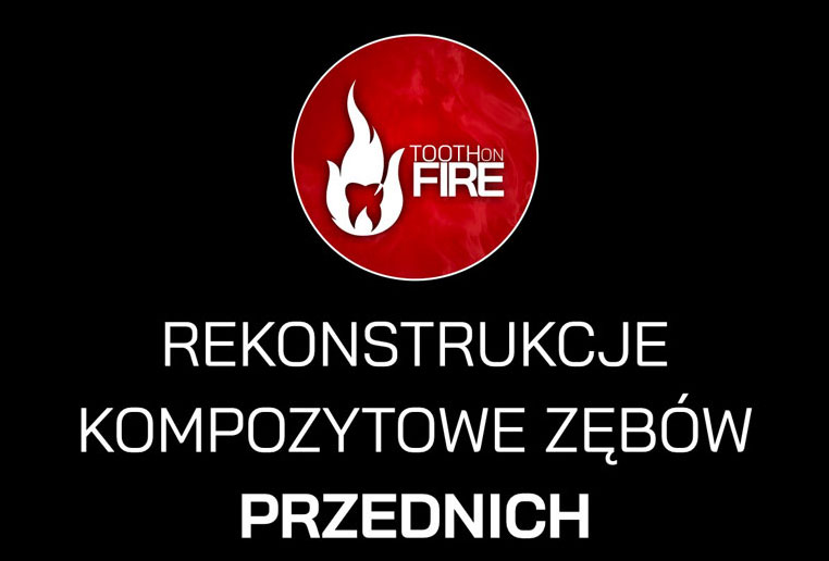 REKONSTRUKCJE KOMPOZYTOWE ZĘBÓW PRZEDNICH