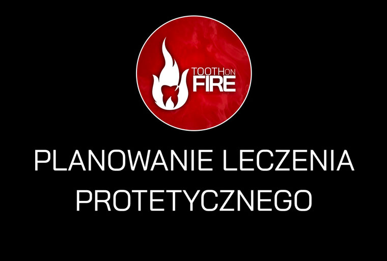 PLANOWANIE LECZENIA PROTETYCZNEGO