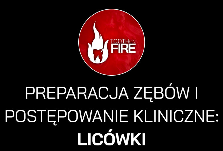 PREPARACJA ZĘBÓW I POSTĘPOWANIE KLINICZNE: LICÓWKI