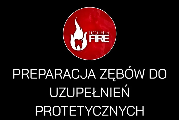 PREPARACJA ZĘBÓW DO UZUPEŁNIEŃ PROTETYCZNYCH